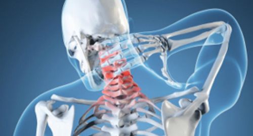 Bolezni vratnega dela hrbtenice